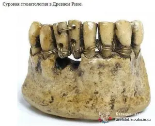 Стоматологія в Римі
