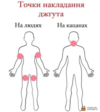 Як накладати джгут москалям